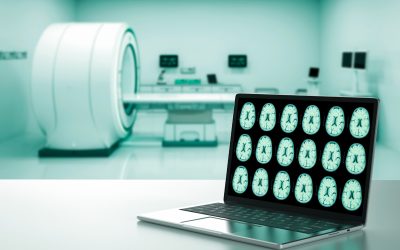 CTE: The Long-Term Effects of Concussion on the Brain